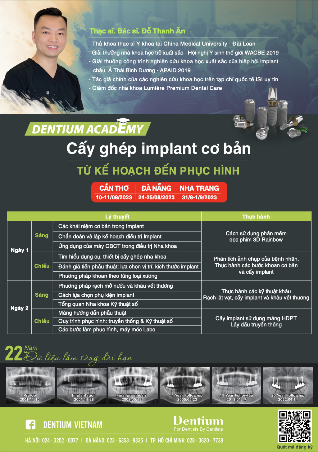 Sự kiện Khóa học cấy ghép Implant của công ty Dentium